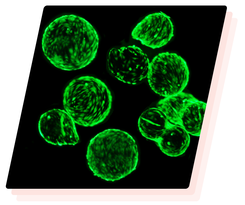NB-Microcarriers Nexture Bio's microcarriers